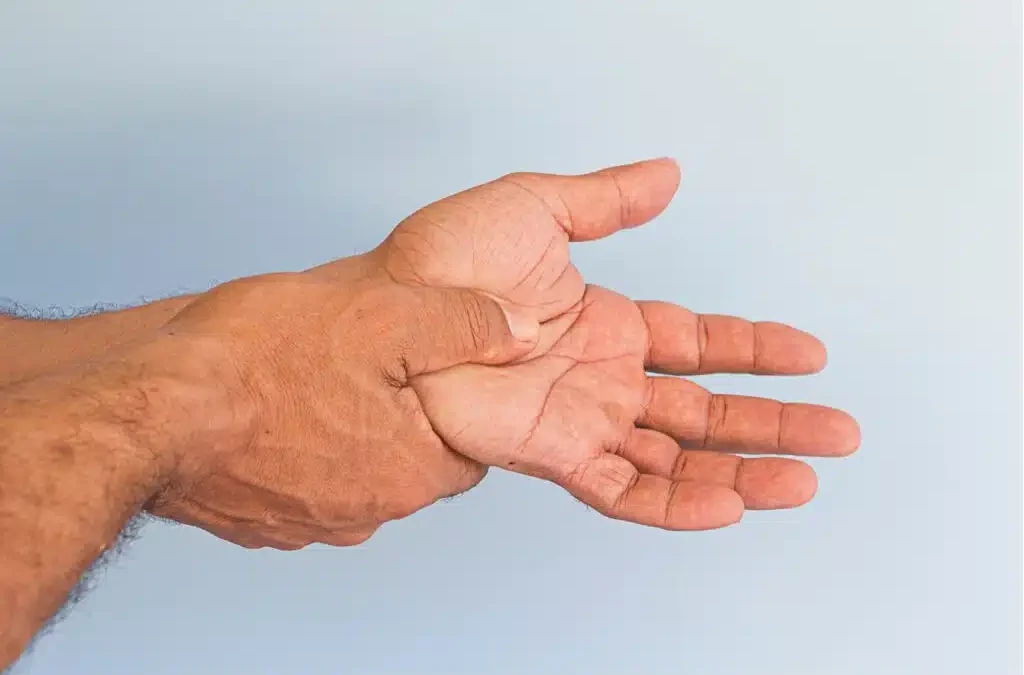 9 Early Signs of Arthritis You Should Never Ignore
